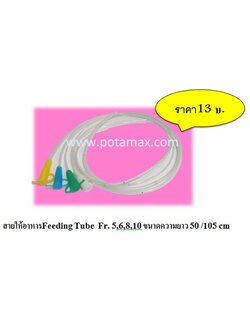 สายให้อาหาร (Feeding Tube)