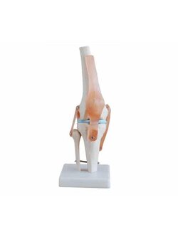 หุ่นจำลองกระดูกข้อเข่า