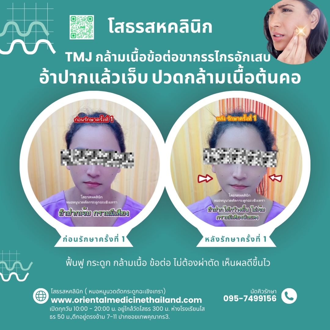 ปวดข้อต่อขากรรไกร -"โรคข้อต่อขากรรไกร" แก้อาการหันคอไม่ได้ เงยคอไม่ได้ กระดูกคอเคลื่อน กรามมีเสียง : โสธรสหคลินิก ฉะเชิงเทรา