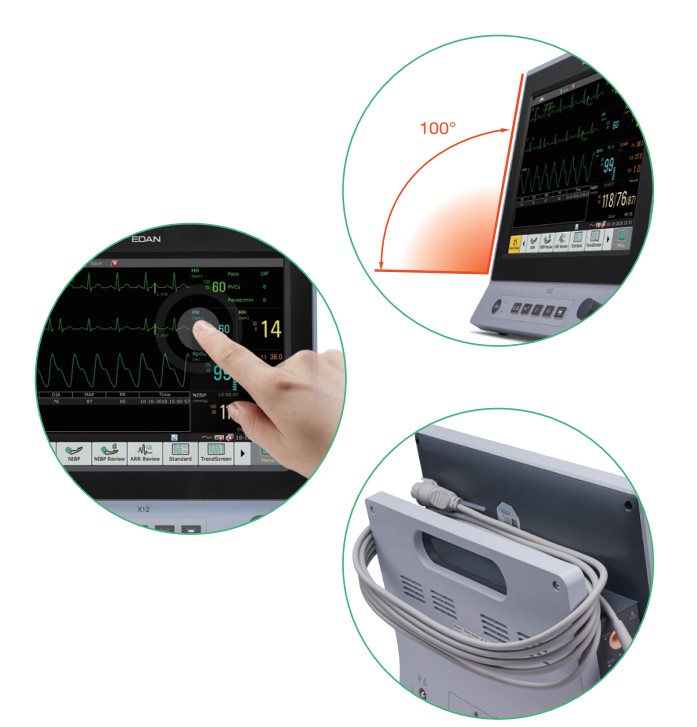 เครื่องติดตามสัญญาณชีพผู้ป่วย รุ่น X series Patient Monitor