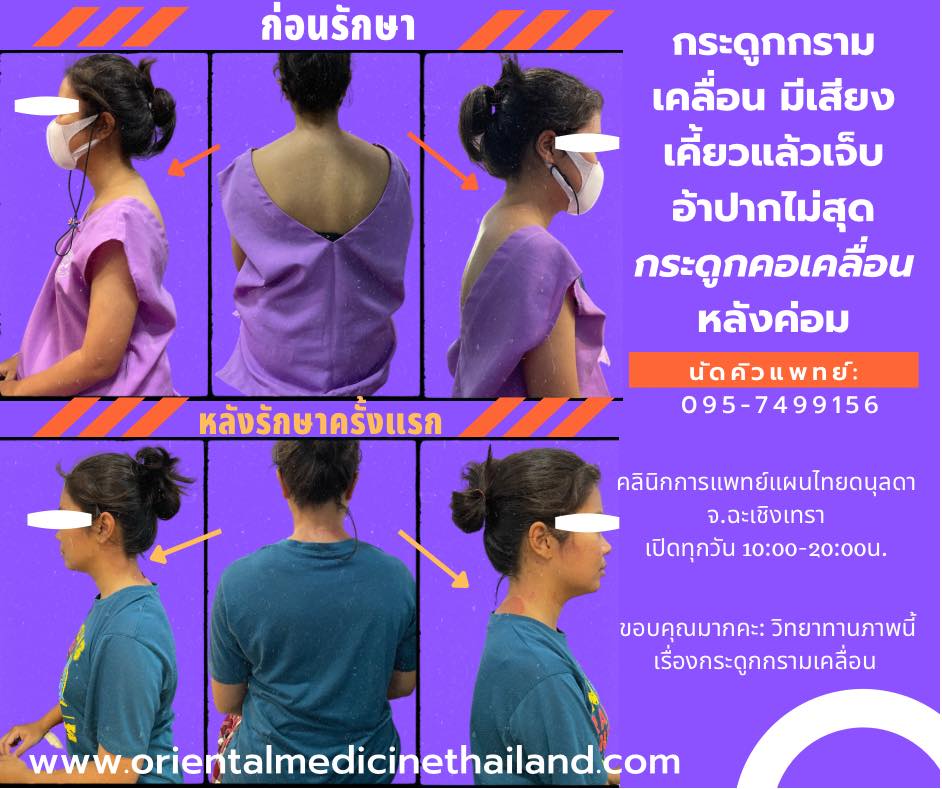 แก้อาการกรามมีเสียงดัง กระดูกกรามเคลื่อน อ้าปากไม่ได้ กระดูกคอเคลื่อน หลังค่อม แก้อาการกรามมีเสียงดัง แก้อาการกรามล็อค
