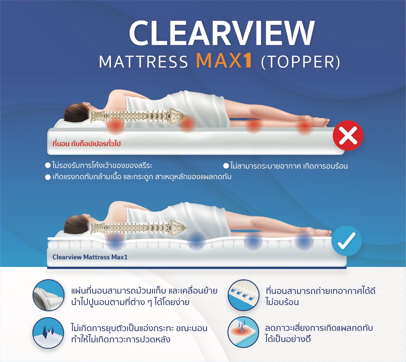 CLEARVIEW MATTRESS MAX1 (TOPPER) ที่นอนโฟมป้องกันแผลกดทับ