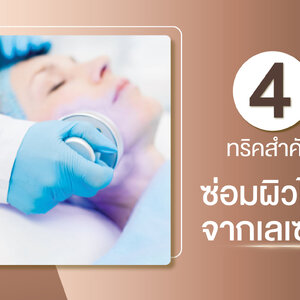 4 ทริค ซ่อมผิวไหม้ กู้ผิวหลังเลเซอร์